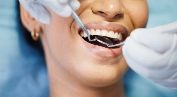 Best Emergency Treatment for Dental Infections or Abscesses in Lake Los Angeles, CA